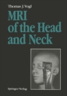 MRI of the Head and Neck : Functional Anatomy - Clinical Findings - Pathology - Imaging - eBook