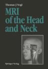 MRI of the Head and Neck : Functional Anatomy - Clinical Findings - Pathology - Imaging - Book