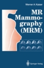 MR Mammography (MRM) - eBook