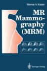 MR Mammography (MRM) - Book