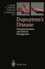 Dupuytren's Disease : Pathobiochemistry and Clinical Management - eBook