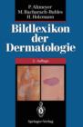 Bildlexikon Der Dermatologie - Book