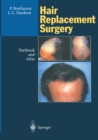 Hair Replacement Surgery : Textbook and Atlas - eBook