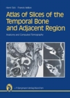 Atlas of Slices of the Temporal Bone and Adjacent Region : Anatomy and Computed Tomography Horizontal, Frontal, Sagittal Sections - Book