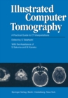 Illustrated Computer Tomography : A Practical Guide to CT Interpretations - eBook