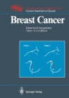 Breast Cancer - eBook