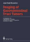 Imaging of Gastrointestinal Tract Tumors - eBook