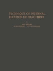 Technique of Internal Fixation of Fractures - eBook
