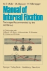Manual of Internal Fixation : Technique Recommended by the AO-Group Swiss Association for the Study of Internal Fixation: ASIF - eBook