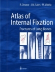 Atlas of Internal Fixation : Fractures of Long Bones - Book