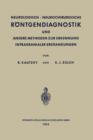 Neurologisch-Neurochirurgische Roentgendiagnostik Und Andere Methoden Zur Erkennung Intrakranialer Erkrankungen - Book