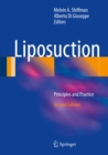 Liposuction : Principles and Practice - eBook