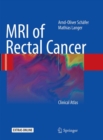 MRI of Rectal Cancer : Clinical Atlas - Book
