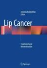 Lip Cancer : Treatment and Reconstruction - Book