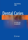 Dental Caries : Principles and Management - Book