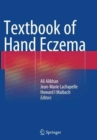 Textbook of Hand Eczema - Book