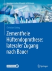 Zementfreie Huftendoprothese: lateraler Zugang nach Bauer - Book