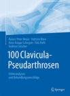 100 Clavicula-Pseudarthrosen : Fehleranalysen und Behandlungsvorschlage - Book
