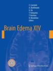 Brain Edema XIV - Book