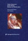 Intracranial Germ Cell Tumors - eBook