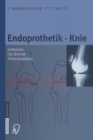 Endoprothetik Knie - Book