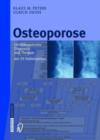 Osteoporose : Leitliniengerechte Diagnostik Und Therapie MIT 25 Fallbeispielen - Book