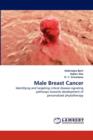 Male Breast Cancer - Book