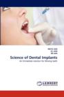 Science of Dental Implants - Book
