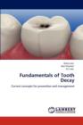 Fundamentals of Tooth Decay - Book