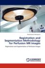 Registration and Segmentation Methodology for Perfusion MR Images - Book