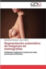 Segmentacion Automatica de Imagenes de Mamografias - Book