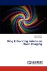 Ring Enhancing Lesions on Brain Imaging - Book