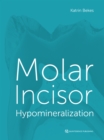 Molar Incisor Hypomineralization - eBook