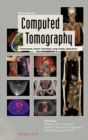 Computed Tomography - eBook