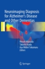 Neuroimaging Diagnosis for Alzheimer's Disease and Other Dementias - Book