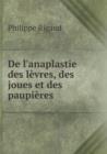 de L'Anaplastie Des Levres, Des Joues Et Des Paupieres - Book