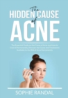 The Hidden Cause of Acne : The Essential Guide on the Cause of Acne and How to Cure it Permanently, Discover the Cause and Treatments Available to Get Rid of Acne Permanently - Book