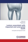 Lesions associated with impacted and unerupted tooth - Book