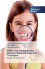 Tooth size discrepancies between Class I & Class II in Davangere - Book