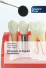 Occlusion In Implant Prosthesis - Book