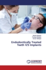 Endodontically Treated Teeth V/S Implants - Book