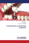 Crestal Bone and Dental Implants - Book