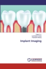 Implant Imaging - Book