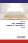 Tooth and Implant Supported Overdentures - Book