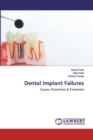 Dental Implant Failures - Book