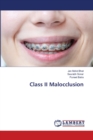 Class II Malocclusion - Book