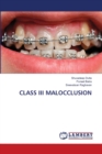 Class III Malocclusion - Book