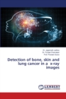 Detection of bone, skin and lung cancer in a x-ray images - Book