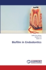 Biofilm in Endodontics - Book