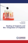 Healing of Implants and Bio- Integration of Implants - Book
